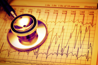 EKG